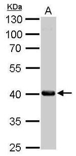 FAH Antibody in Western Blot (WB)