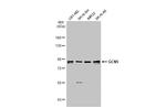 GCN5 Antibody in Western Blot (WB)