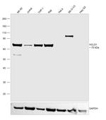 HCLS1 Antibody in Western Blot (WB)