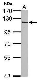 INPP4A Antibody in Western Blot (WB)