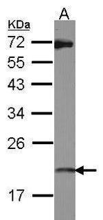 ISG20 Antibody in Western Blot (WB)