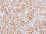 L-Plastin Antibody in Immunohistochemistry (Paraffin) (IHC (P))