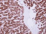 ALDH6A1 Antibody in Immunohistochemistry (Paraffin) (IHC (P))