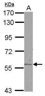 ALDH6A1 Antibody in Western Blot (WB)