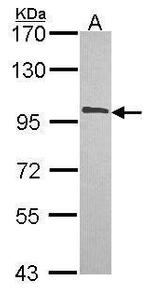 NCBP1 Antibody in Western Blot (WB)