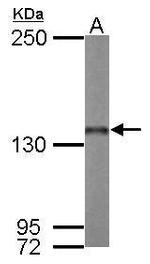 Nardilysin Antibody in Western Blot (WB)