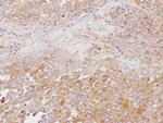 OSBP Antibody in Immunohistochemistry (Paraffin) (IHC (P))