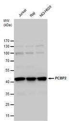 PCBP2 Antibody in Western Blot (WB)