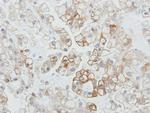 PDZK1 Antibody in Immunohistochemistry (Paraffin) (IHC (P))