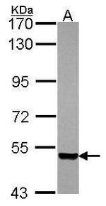 PDZK1 Antibody in Western Blot (WB)