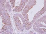 PPP2R3A Antibody in Immunohistochemistry (Paraffin) (IHC (P))