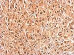 PSMC4 Antibody in Immunohistochemistry (Paraffin) (IHC (P))