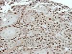 PSMC5 Antibody in Immunohistochemistry (Paraffin) (IHC (P))