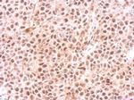 PSMC6 Antibody in Immunohistochemistry (Paraffin) (IHC (P))