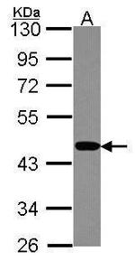 PSMC6 Antibody in Western Blot (WB)