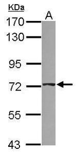 ABCD4 Antibody in Western Blot (WB)