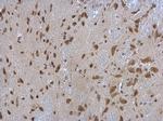 RPL3 Antibody in Immunohistochemistry (Paraffin) (IHC (P))