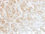 RPL3 Antibody in Immunohistochemistry (Paraffin) (IHC (P))