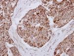 MRPL12 Antibody in Immunohistochemistry (Paraffin) (IHC (P))