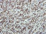 SATB1 Antibody in Immunohistochemistry (Paraffin) (IHC (P))