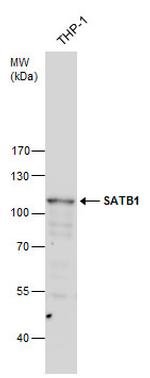 SATB1 Antibody in Western Blot (WB)