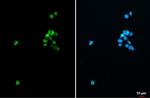 SATB1 Antibody in Immunocytochemistry (ICC/IF)