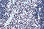 SATB1 Antibody in Immunohistochemistry (Paraffin) (IHC (P))