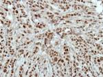 HLTF Antibody in Immunohistochemistry (Paraffin) (IHC (P))