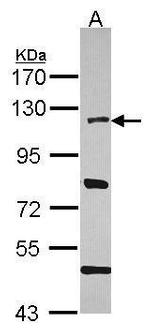 HLTF Antibody in Western Blot (WB)