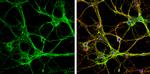 MUNC18 Antibody in Immunocytochemistry (ICC/IF)