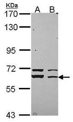 MUNC18 Antibody in Western Blot (WB)