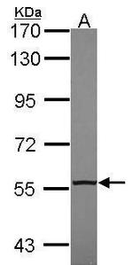 NR2C2 Antibody in Western Blot (WB)