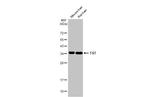 TST Antibody in Western Blot (WB)