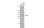 TST Antibody in Western Blot (WB)