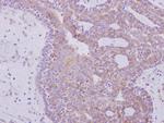 RPL6 Antibody in Immunohistochemistry (Paraffin) (IHC (P))