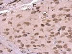 RPL6 Antibody in Immunohistochemistry (Paraffin) (IHC (P))