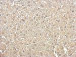 Aldolase B Antibody in Immunohistochemistry (Paraffin) (IHC (P))