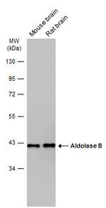 Aldolase B Antibody in Western Blot (WB)