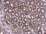 SRSF1 Antibody in Immunohistochemistry (Paraffin) (IHC (P))