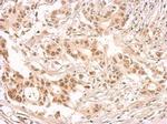 SRSF1 Antibody in Immunohistochemistry (Paraffin) (IHC (P))