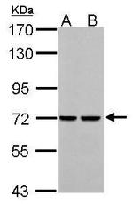 PCK2 Antibody in Western Blot (WB)