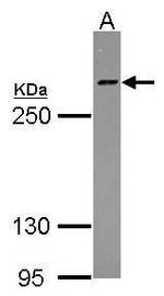 HCFC1 Antibody in Western Blot (WB)