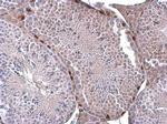 ERF Antibody in Immunohistochemistry (Paraffin) (IHC (P))