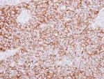 PLCD1 Antibody in Immunohistochemistry (Paraffin) (IHC (P))