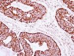 CLPP Antibody in Immunohistochemistry (Paraffin) (IHC (P))