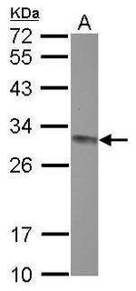 CLPP Antibody in Western Blot (WB)