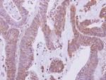 HDHD1 Antibody in Immunohistochemistry (Paraffin) (IHC (P))