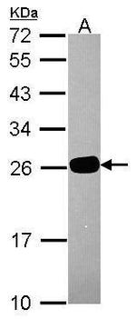 HDHD1 Antibody in Western Blot (WB)