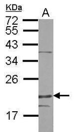 DENR Antibody in Western Blot (WB)