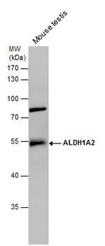 ALDH1A2 Antibody in Western Blot (WB)